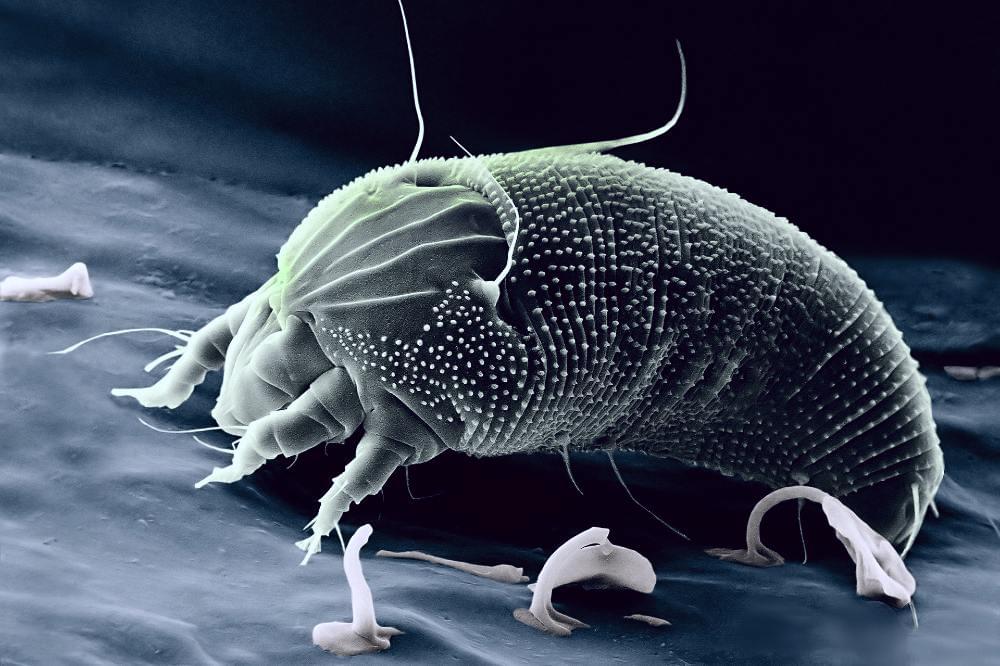 How to remove dust mite allergies from your home 448060